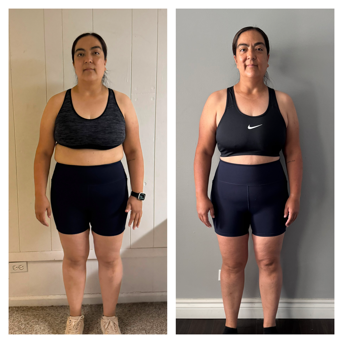 Marisol Morales Before / After