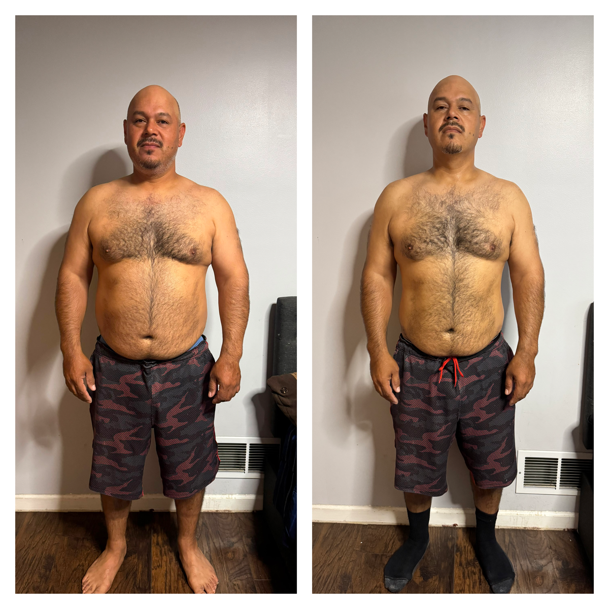 Miguel Herreras Before / After